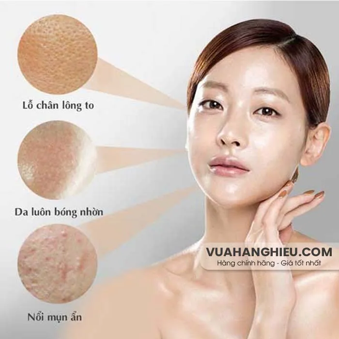 Top 12 kem dưỡng cho da dầu được nhiều khách hàng yêu thích được yêu thích năm 2025