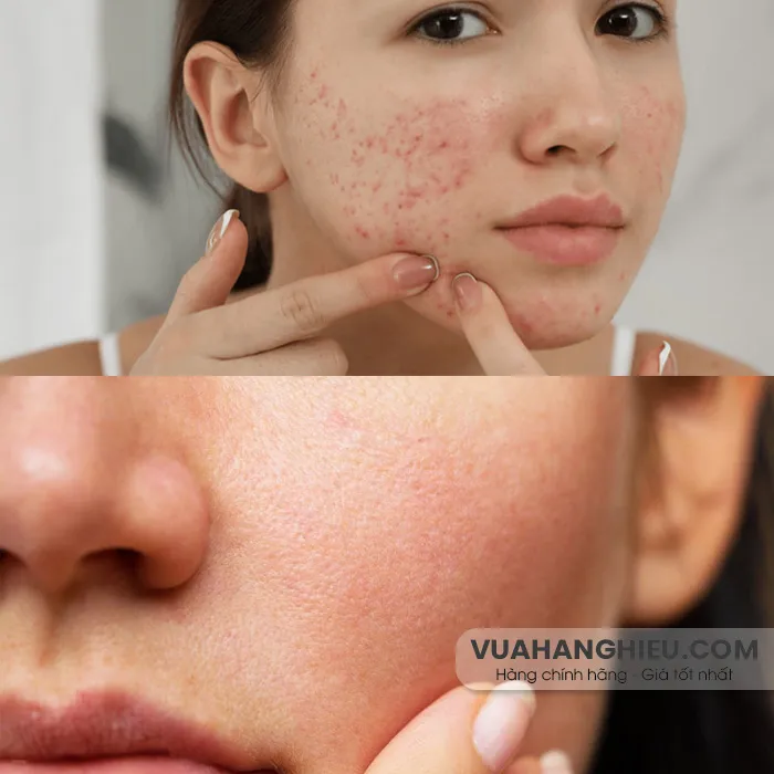 11 cách đẩy nhanh quá trình tái tạo da tự nhiên thân thiện với làn da, hiệu quả