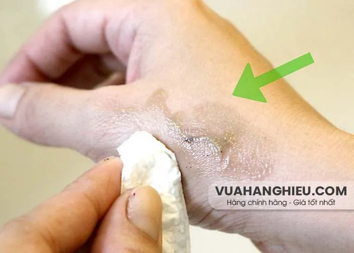 9+ cách tẩy thuốc nhuộm tóc dính trên da dễ dàng