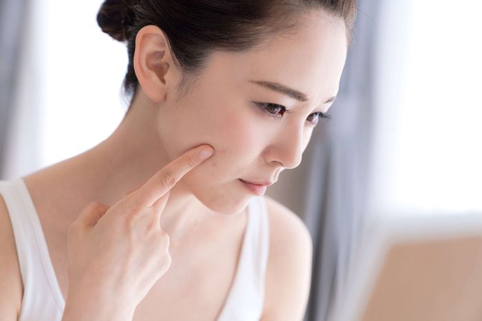 Cách hỗ trợ làm sạch mụn khi mang thai thân thiện với làn da và hiệu quả được bác sĩ khuyên dùng