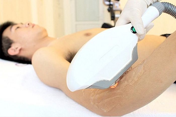 7 cách triệt lông cho nam giới tại nhà thân thiện với làn da, nhanh chóng