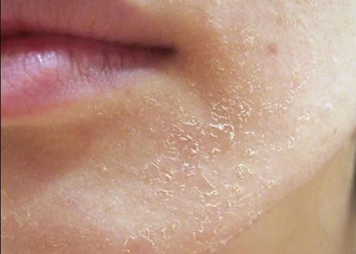 5 cách phân biệt sữa rửa mặt La Roche Posay thật giả