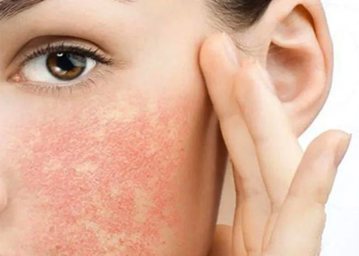 5 cách phân biệt sữa rửa mặt La Roche Posay thật giả