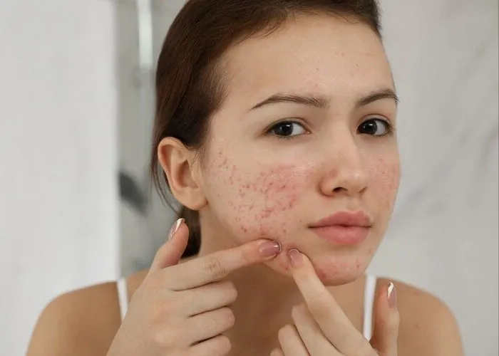 5 cách phân biệt sữa rửa mặt La Roche Posay thật giả