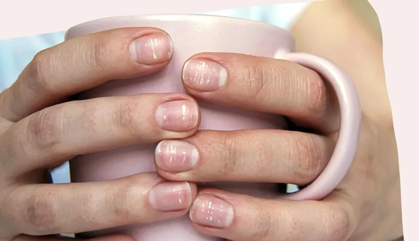 5 cách làm trắng móng tay tại nhà nhanh và hiệu quả