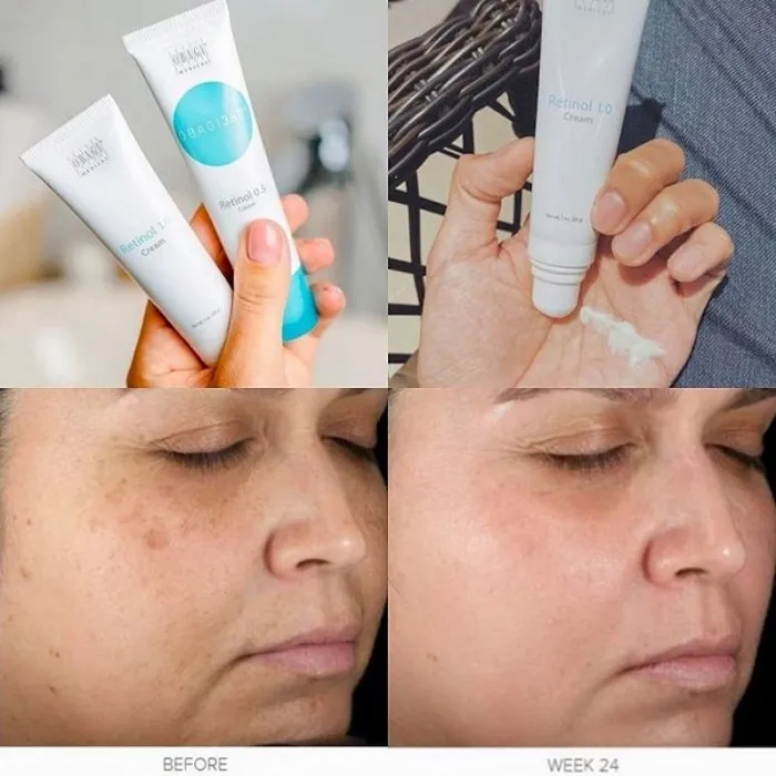 7 cách nhận biết Retinol Obagi thật giả cực chuẩn