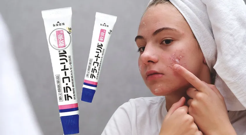 12 loại kem hỗ trợ làm sạch mụn của Nhật được được tìm kiếm nhiều năm 2025 - 6