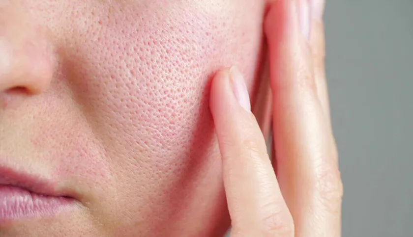 15 sản phẩm thu nhỏ lỗ chân lông chất lượng tốt cho làn da hoàn hảo