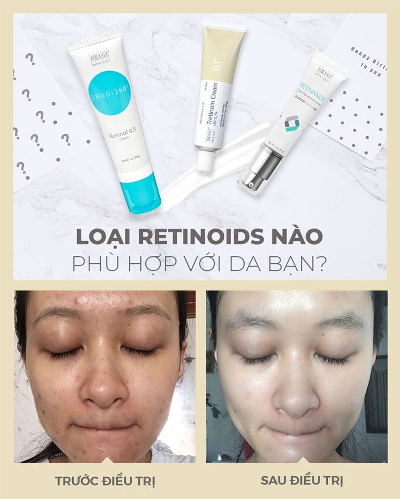 Giải đáp: Sử dụng Retinol có làm mỏng da không? - 2