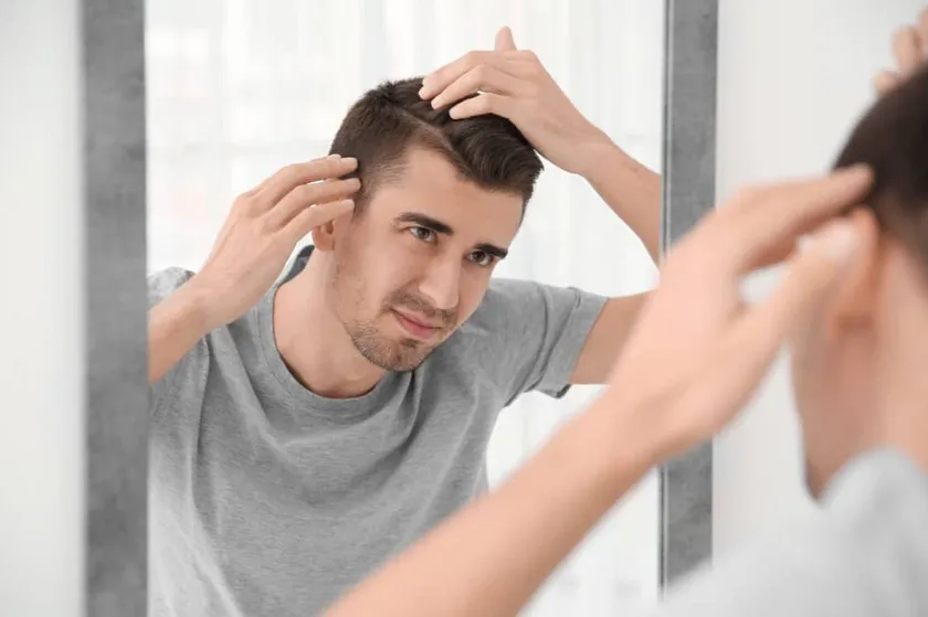 Top 15 kiểu tóc cho nam tóc thưa mỏng, đầu hói đẹp