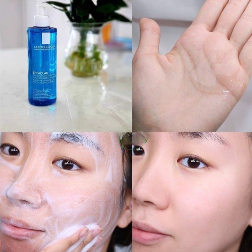 Các bước skincare cho tuổi dậy thì đơn giản, hiệu quả