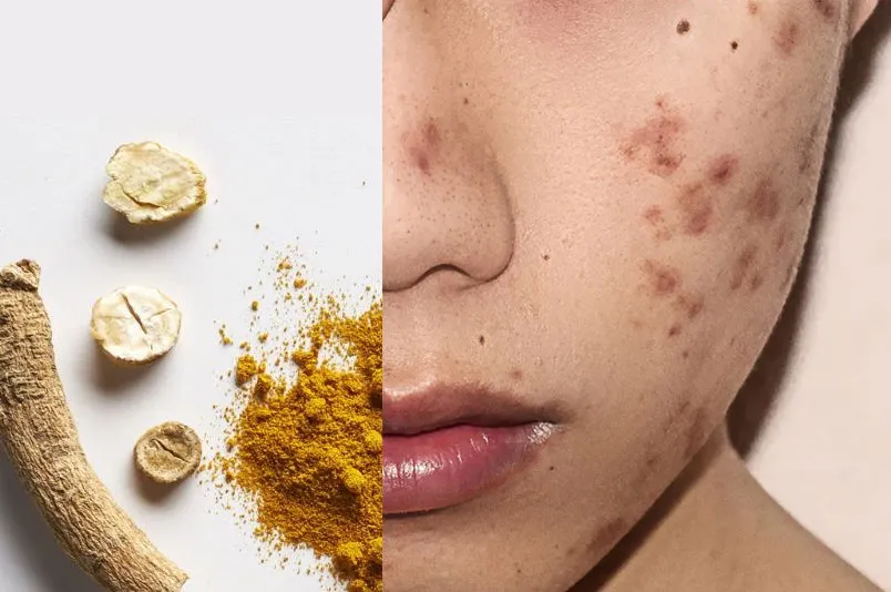 Curcuma Longa Root Extract là gì trong mỹ phẩm? Tác dụng gì? - 2
