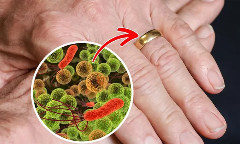 Giải đáp: Tại sao nên tháo trang sức trước khi ngủ? - 3