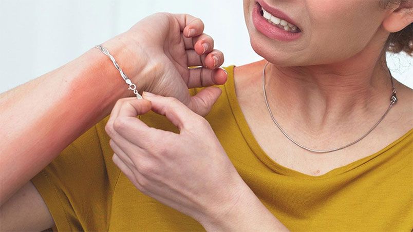 Giải đáp: Tại sao nên tháo trang sức trước khi ngủ? - 1