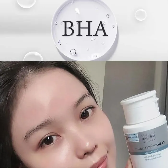BHA kết hợp với gì để hỗ trợ làm sạch mụn? Cách kết hợp với BHA rất chi tiết