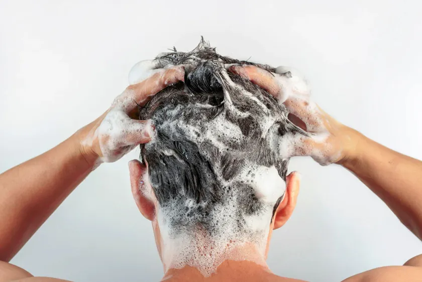 Nguyên nhân rụng tóc ở nam giới và 9 cách khắc phục hiệu quả