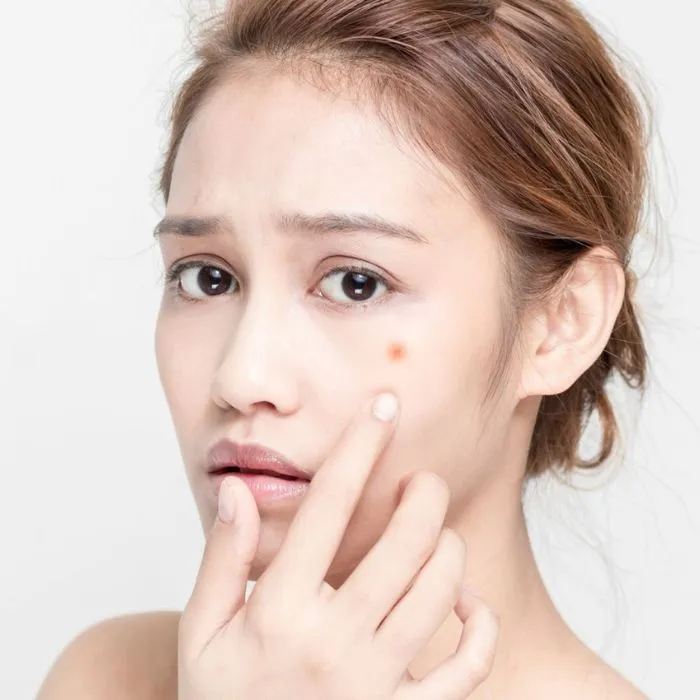 Top 10 loại sữa rửa mặt cho da mụn được chị em săn lùng nhiều - 3