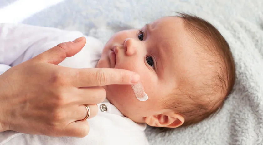 Top 12 kem dưỡng ẩm cho bé bị viêm da cơ địa được nhiều khách hàng yêu thích cho mẹ tham khảo