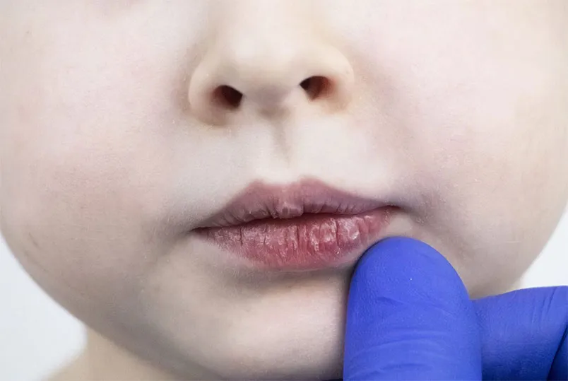 Top 10 son dưỡng môi cho bé thân thiện với làn da, chống nẻ hiệu quả