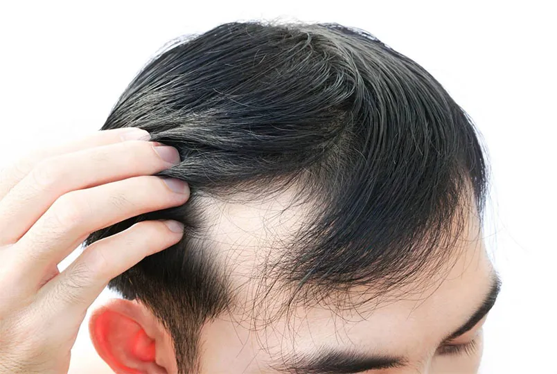 Tóc bò liếm là gì? Tóc bò liếm để mái gì che khuyết điểm?
