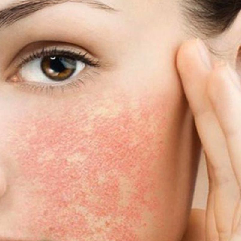 Giải đáp thắc mắc AHA có dùng cho bà bầu được không? - 5