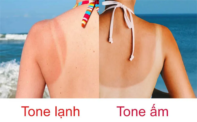 Cách xác định tone da dựa vào Skintone và Undertone uy tín