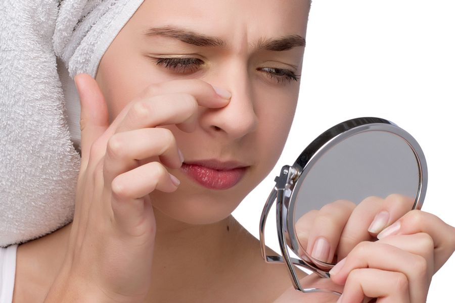 Nặn mụn xong nên làm gì? Hướng dẫn các bước chăm sóc da sau nặn mụn uy tín