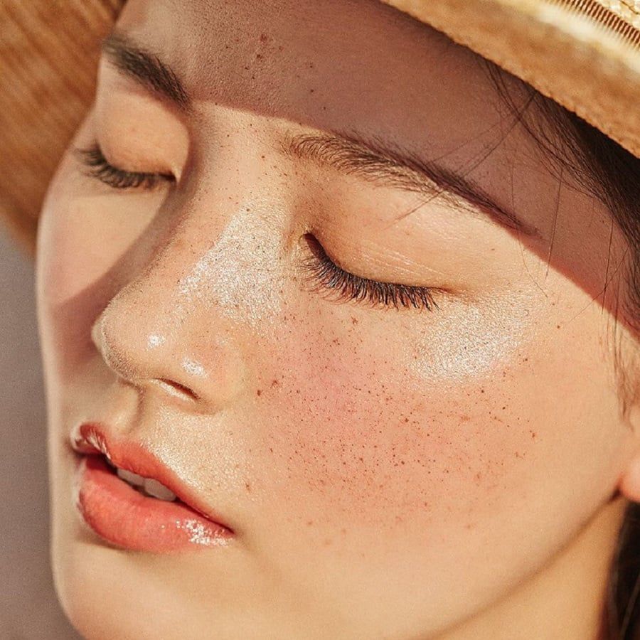 Má hồng và tàn nhang