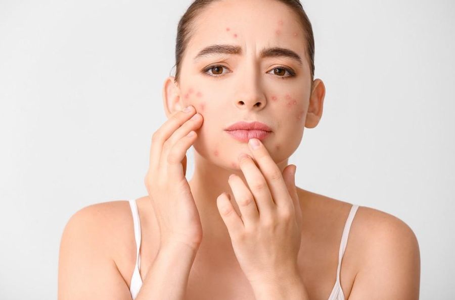 Da có dấu hiệu break out