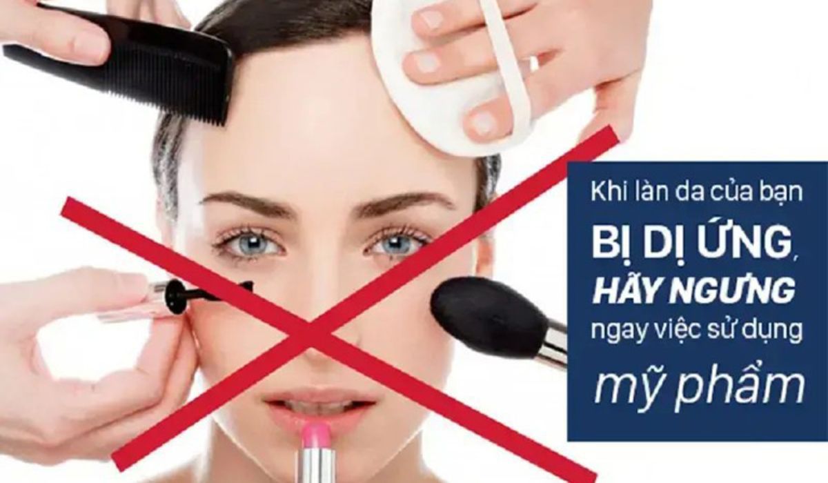 Dấu hiệu dị ứng mỹ phẩm bạn nổi trội định phải chú ý