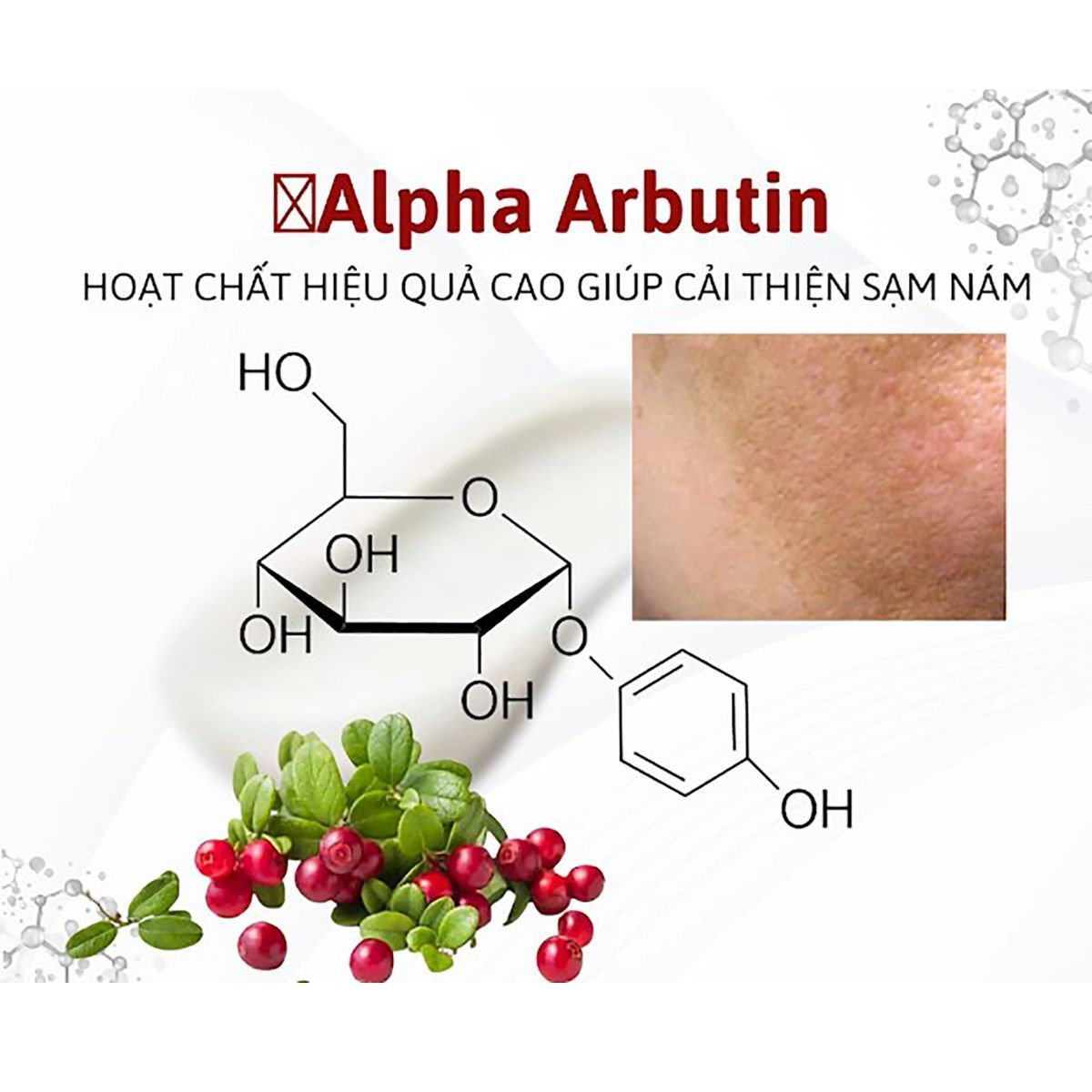 Top 7 hoạt chất trị thâm mụn, thâm nám được nhiều khách hàng yêu thích hiện nay - 7