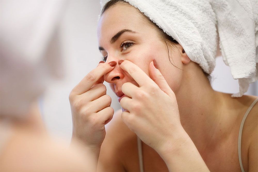 6 sai lầm khi hỗ trợ làm sạch mụn đầu đen mà bạn cần tránh khi chăm sóc da tại nhà