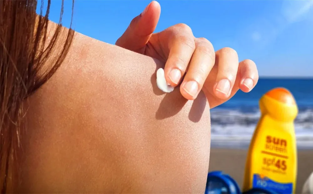 Đi biển về bị đen da phải làm sao? Tips chữa đen da sau khi đi biển  - 13