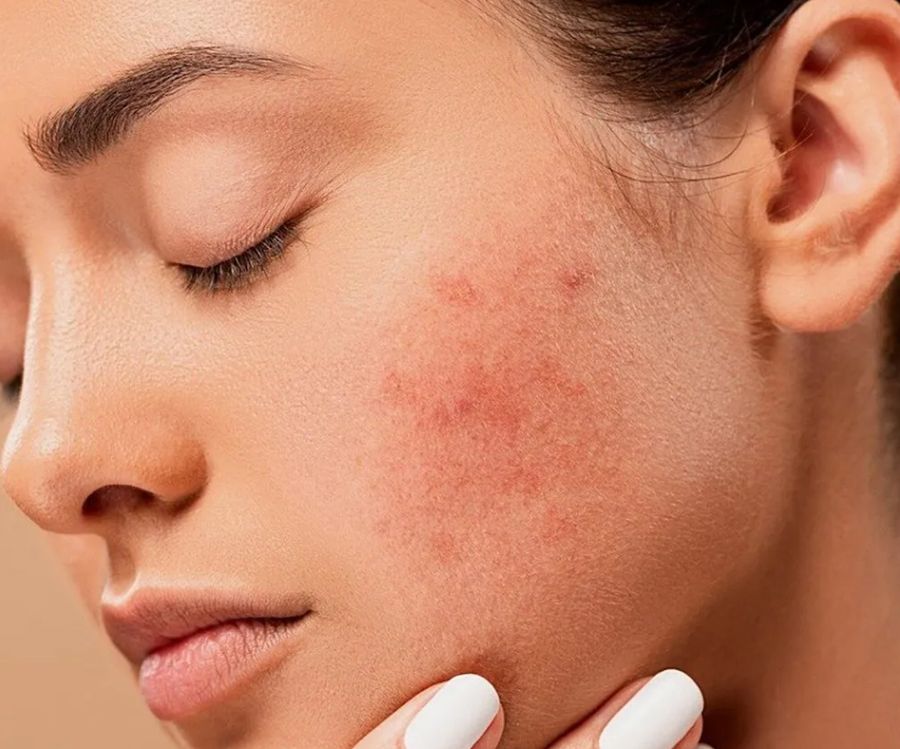 8 loại kem chống nắng không nên dùng tránh gây hại cho làn da