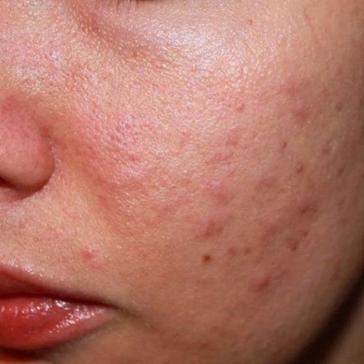 Hướng dẫn dùng Tre Obagi đúng cách trong quy trình dưỡng da - 12