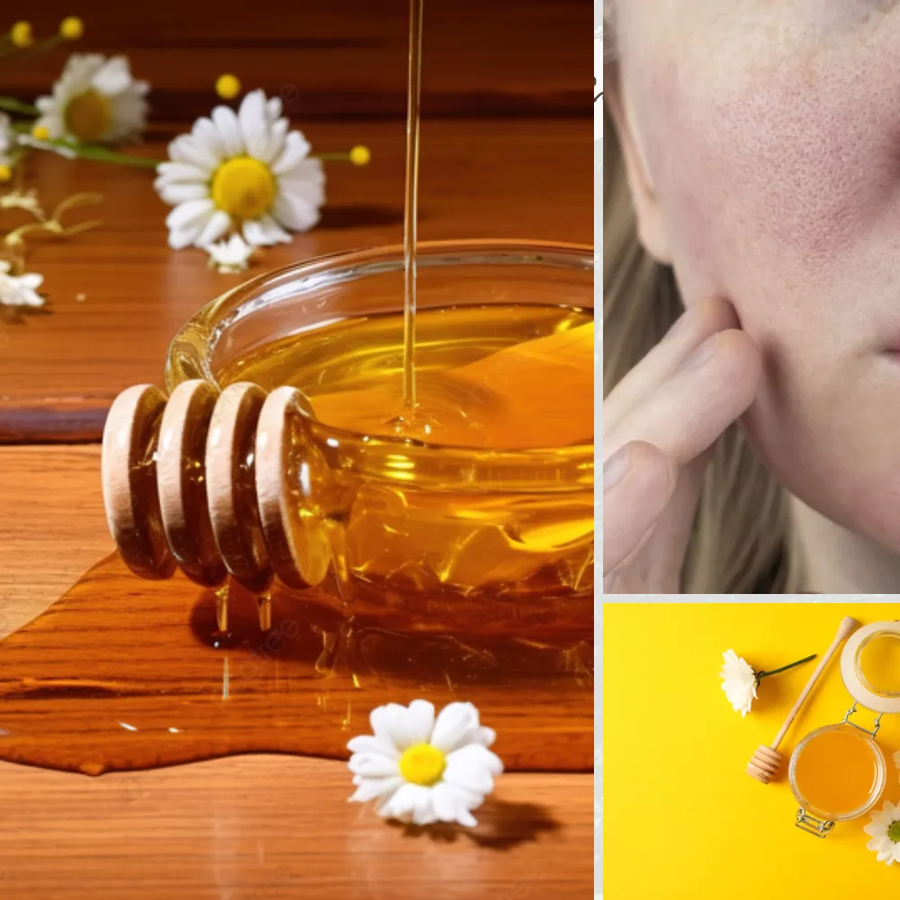 Cách thu nhỏ lỗ chân lông to ở tuổi dậy thì hiệu quả