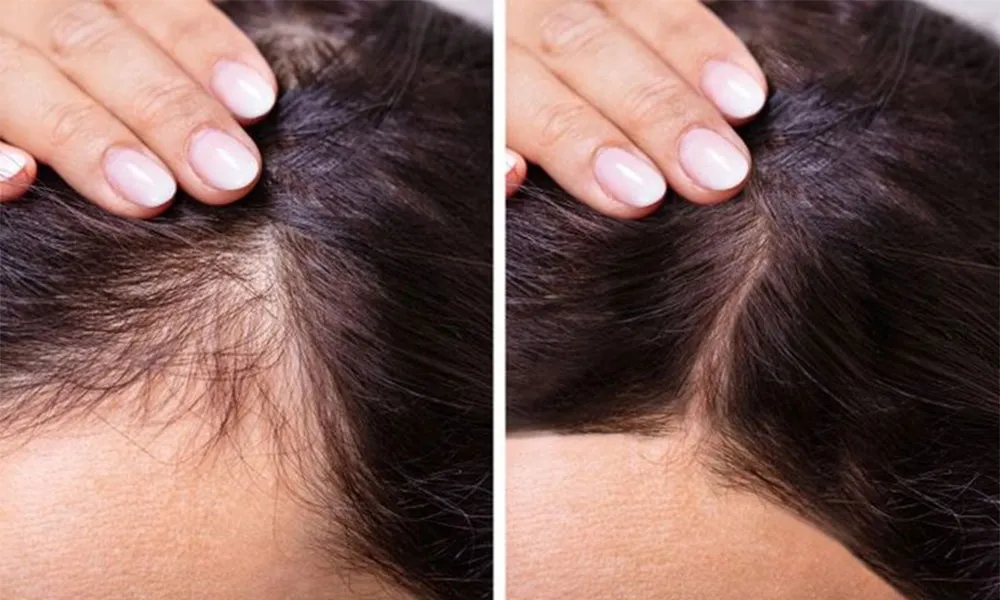 Dầu gội gừng có tác dụng gì? Top 3 dầu gội gừng được đánh giá tốt