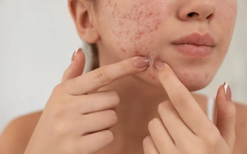 Cách Bôi Kem Chống Nắng Giúp Bảo Vệ Da Toàn Diện, Hiệu Quả Nhanh