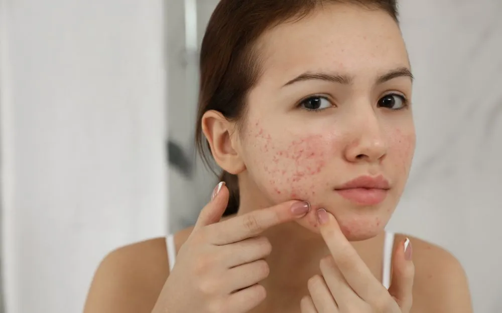 Top 10 Kem Chống Nắng Vichy Bán Chạy, Hot Hit Năm 2025