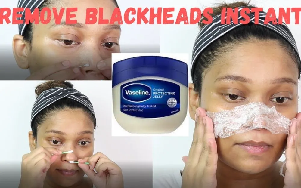 Mẹo Hỗ Trợ Làm Sạch Mụn Đầu Đen Ở Mũi Bằng Vaseline Hiệu Quả - 2