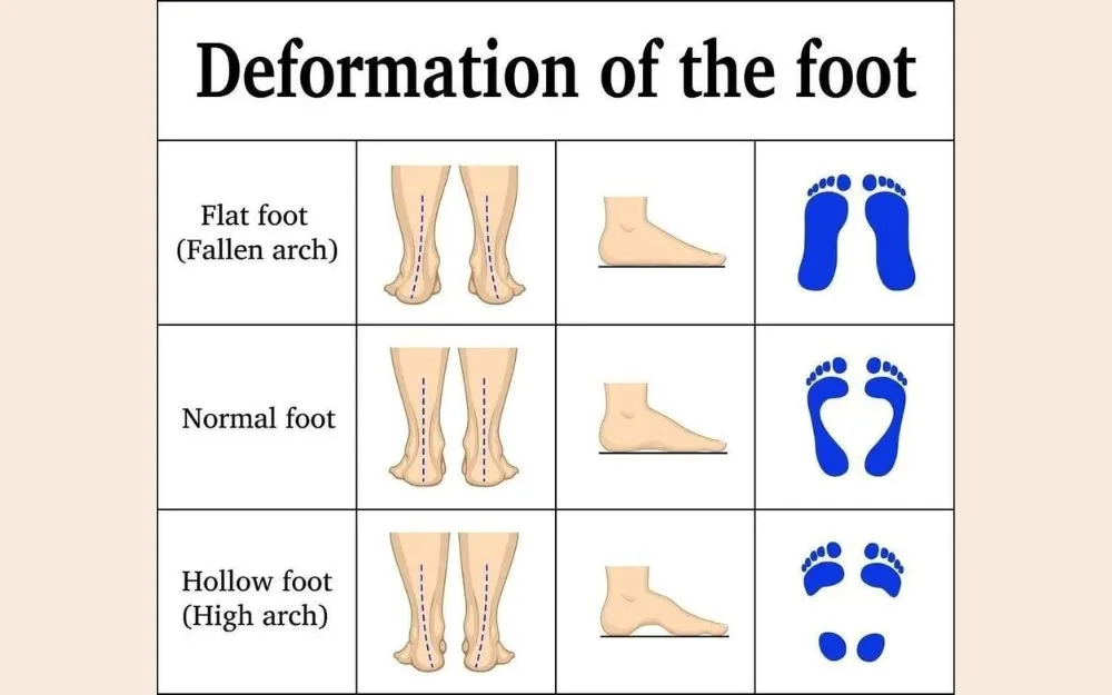 10 Cách Chọn Giày Lười Phù Hợp Với Vóc Dáng, Phong Thái