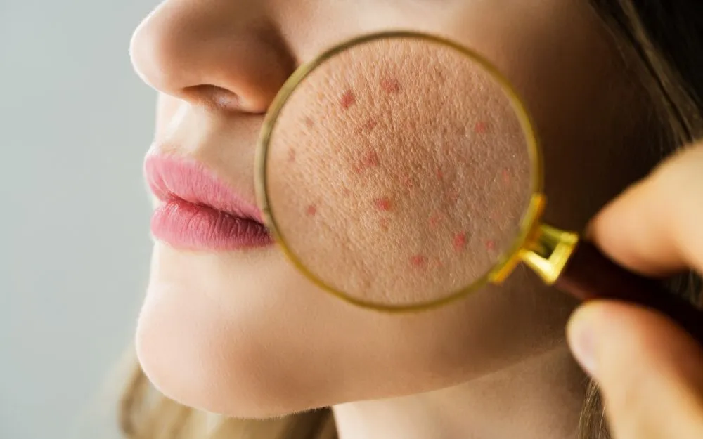 Tips Xác Định Độ Ph Sữa Rửa Mặt Và Cách Chọn Loại Phù Hợp Với Da