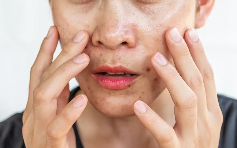 Tips Xác Định Độ Ph Sữa Rửa Mặt Và Cách Chọn Loại Phù Hợp Với Da