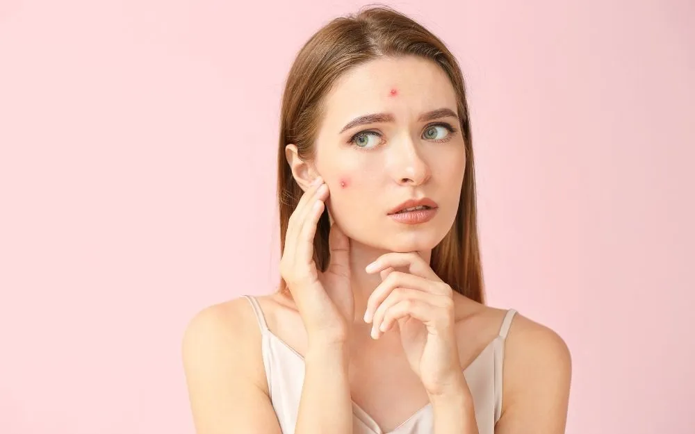 Mụn Bọc: Đặc Điểm, Nguyên Nhân Và Cách Khắc Phục Hiệu Quả