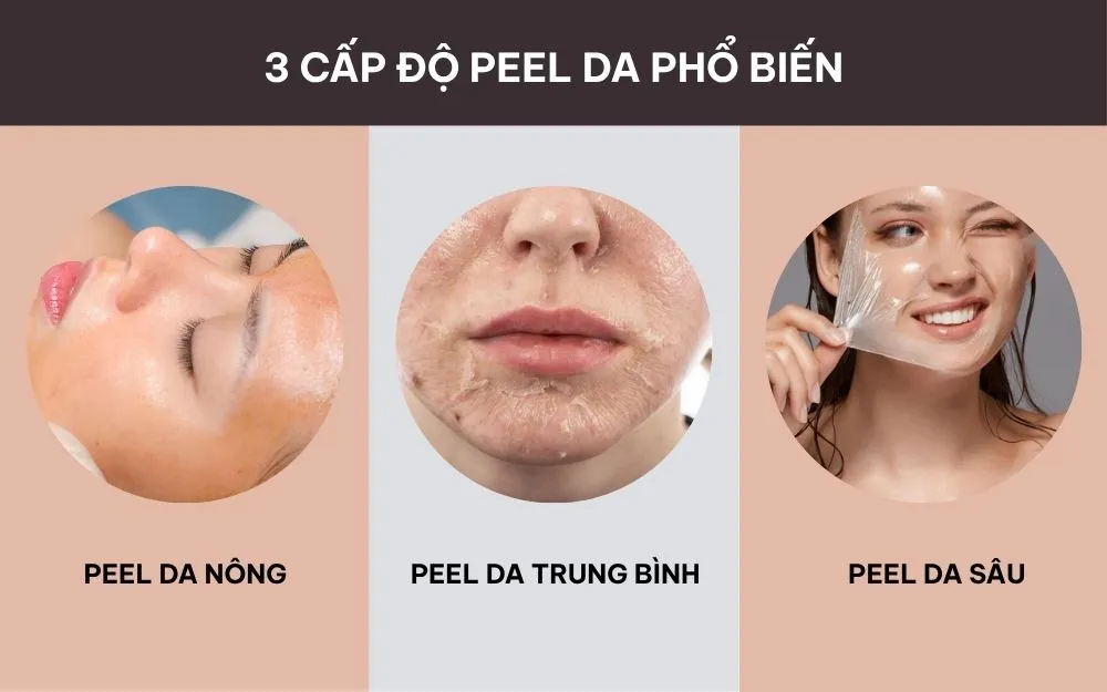 Peel Da Là Gì, Có Tốt Không? Cách Chăm Sóc Sau Khi Peel Da - 2