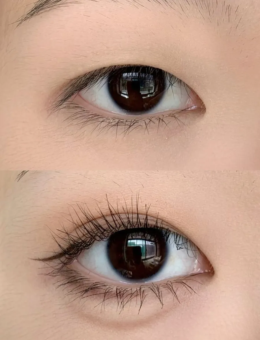 Những điều bình thường và bất thường khi nối mi 