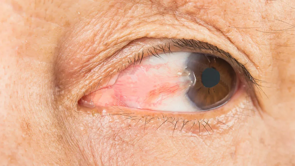 Top 10 khẩu trang chống tia UV bán chạy, nên mua 2026 - 2