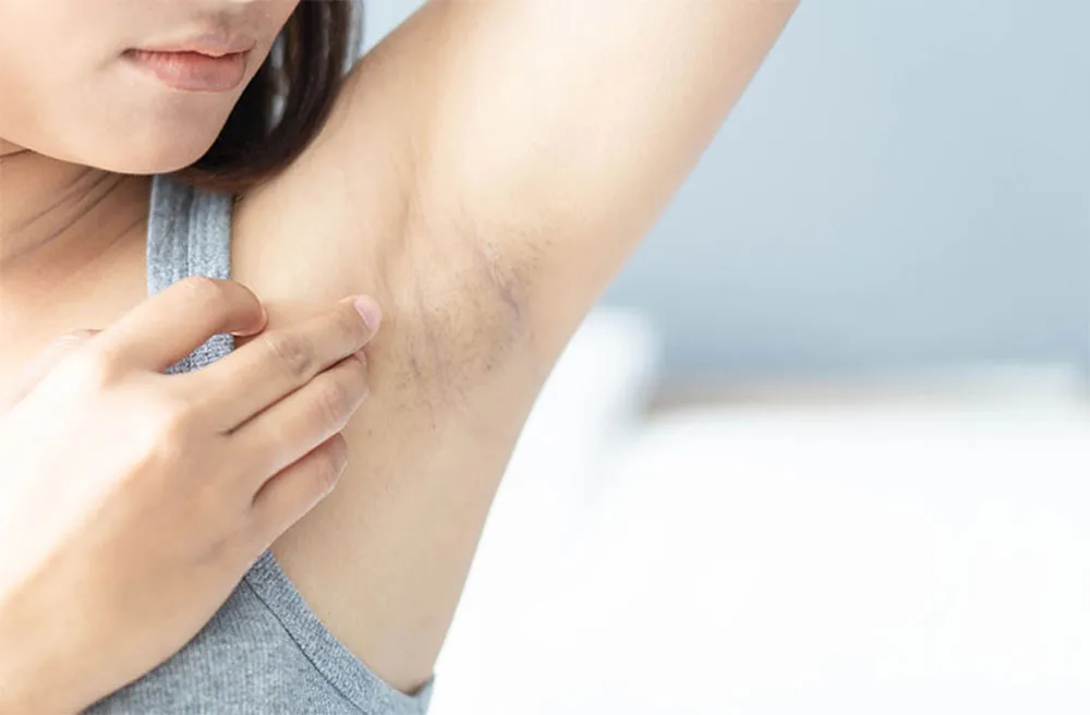 3 Cách Làm Trắng Da Dưới Cánh Tay Giảm Thâm Sạm Hiệu Quả - 1