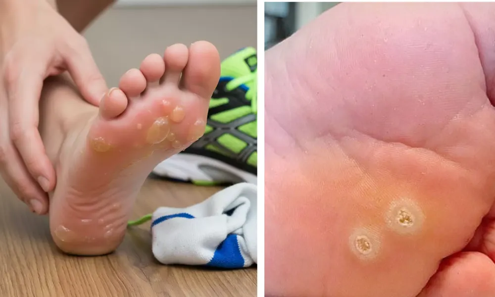 Chân bè nên đi giày gì? Các kiểu giày cho người chân bè - 2