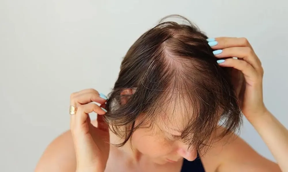 Chia sẻ kinh nghiệm giảm rụng tóc hiệu quả mà các chị em nên lưu ngay! - 2
